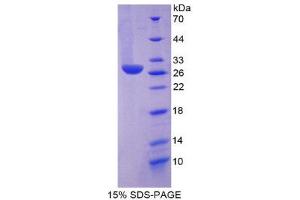 SDS-PAGE (SDS) image for Histidine Decarboxylase (HDC) (AA 160-369) protein (His tag) (ABIN2125207) (HDC Protein (AA 160-369) (His tag))