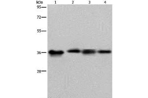 Western Blot analysis of HepG2 and 293T cell, Human kidney cancer tissue and K562 cell using JAM-A Polyclonal Antibody at dilution of 1:500 (F11R antibody)