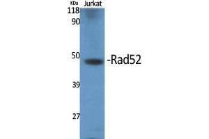 Western Blot (WB) analysis of specific cells using Rad52 Polyclonal Antibody. (RAD52 antibody  (Thr56))