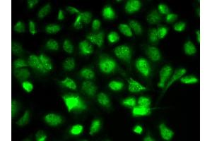 Immunofluorescence analysis of A549 cell using BIRC2 antibody. (BIRC2 antibody)