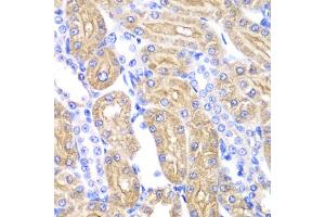Immunohistochemistry of paraffin-embedded rat kidney using ALDH2 antibody. (ALDH2 antibody)