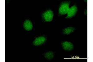 Immunofluorescence of  purified  MaxPab antibody to CBX6 on HeLa cell.