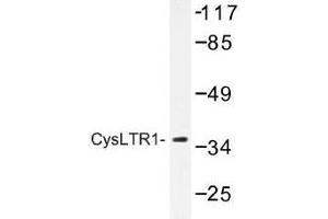 Image no. 1 for anti-Cysteinyl Leukotriene Receptor 1 (CYSLTR1) antibody (ABIN317699) (CysLTR1 antibody)