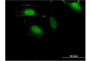 Immunofluorescence of monoclonal antibody to ZNF598 on HeLa cell. (ZNF598 antibody  (AA 28-126))