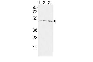Western Blotting (WB) image for anti-Hyaluronan and Proteoglycan Link Protein 1 (HAPLN1) antibody (ABIN3004323) (HAPLN1 antibody)