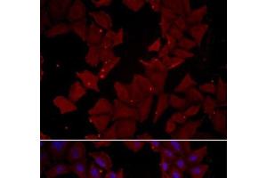 Immunofluorescence analysis of HeLa cells using CCT4 Polyclonal Antibody (CCT4 antibody)