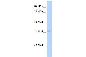 WB Suggested Anti-HHEX Antibody Titration: 0. (HHEX antibody  (C-Term))