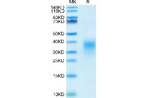 Human ICOS (C136S,C137S) on Tris-Bis PAGE under reduced condition. (ICOS Protein (Cys136Ser-Mutant, Cys137Ser-Mutant) (His tag))