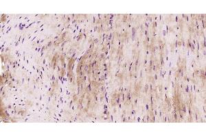 Paraformaldehyde-fixed, paraffin embedded Mouse heart, Antigen retrieval by boiling in sodium citrate buffer (pH6. (FLNC antibody  (AA 251-350))
