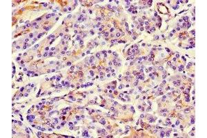 Immunohistochemistry of paraffin-embedded human pancreatic tissue using ABIN7159746 at dilution of 1:100 (MAP1 antibody  (AA 401-600))