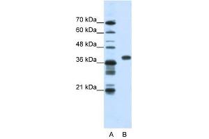 PCBP1 antibody used at 1. (PCBP1 antibody)