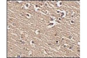 Immunohistochemistry of Slitrk1 in human brain tissue with this product at 2. (SLITRK1 antibody  (C-Term))