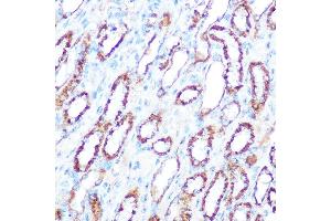 Immunohistochemistry of paraffin-embedded mouse kidney using iNOS antibody (ABIN6129509, ABIN6144728, ABIN6144730 and ABIN6218243) at dilution of 1:100 (40x lens). (NOS2 antibody  (AA 500-730))
