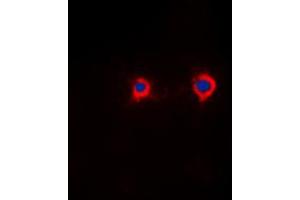 Immunofluorescent analysis of NFAT4 (pS165) staining in HeLa cells. (NFATC3 antibody  (N-Term, pSer165))