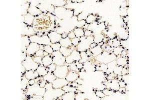 Immunohistochemistry (Paraffin-embedded Sections) (IHC (p)) image for anti-Transducin-Like Enhancer of Split 1 (E(sp1) Homolog, Drosophila) (TLE1) antibody (ABIN7075961)