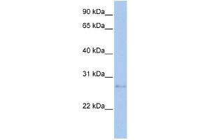 WB Suggested Anti-MDM1 Antibody Titration:  0. (MDM1 antibody  (N-Term))