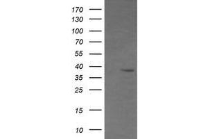 Image no. 1 for anti-CD33 (CD33) antibody (ABIN1497271) (CD33 antibody)