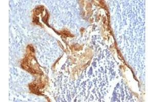 Immunohistochemical staining (Formalin-fixed paraffin-embedded sections) of human tonsil with IVL monoclonal antibody, clone IVRN/827 . (Involucrin antibody)