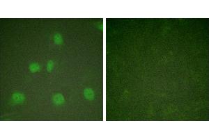 PMA + -Immunofluorescence analysis of HeLa cells, treated with PMA (125ng/ml, 30mins), using Cullin 1 antibody (#C0162). (Cullin 1 antibody)