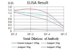 Black line: Control Antigen (100 ng), Purple line: Antigen(10 ng), Blue line: Antigen (50 ng), Red line: Antigen (100 ng), (ASS1 antibody)