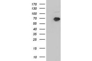 Western Blotting (WB) image for anti-Insulin-Like Growth Factor 2 mRNA Binding Protein 2 (IGF2BP2) antibody (ABIN1498825) (IGF2BP2 antibody)