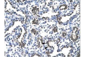 Image no. 2 for anti-FBJ Murine Osteosarcoma Viral Oncogene Homolog B (FOSB) (AA 240-289) antibody (ABIN202278) (FOSB antibody  (AA 240-289))