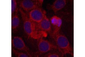 Immunofluorescence staining of methanol-fixed MCF cells using Phospho-KDR-Y1175 antibody. (VEGFR2/CD309 antibody  (pTyr1175))