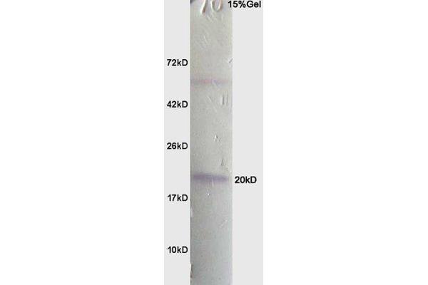 PARK7/DJ1 anticorps  (AA 101-189)