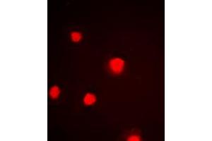 Immunofluorescence (IF) image for anti-Tumor Protein P53 (TP53) (C-Term), (pSer392) antibody (ABIN7301398)