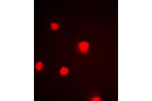 Immunofluorescent analysis of p53 (pS392) staining in HeLa cells.