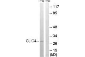 Western blot analysis of extracts from HT-29 cells, using CLIC4 Antibody. (CLIC4 antibody  (AA 1-50))