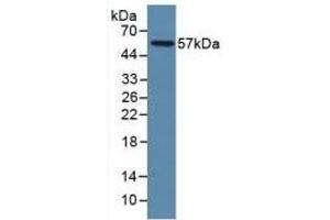 Detection of Recombinant LAMP1, Human using Polyclonal Antibody to Lysosomal Associated Membrane Protein 1 (LAMP1) (LAMP1 antibody  (AA 49-297))