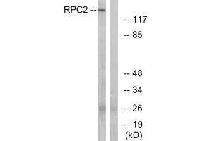 Western blot analysis of extracts from LOVO cells, using RPC2 antibody. (POLR3B antibody)
