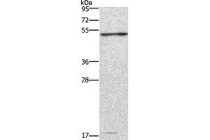 Western blot analysis of Jurkat cell, using CKMT2 Polyclonal Antibody at dilution of 1:700