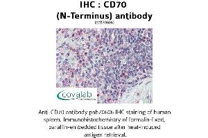 Image no. 2 for anti-CD70 Molecule (CD70) (N-Term) antibody (ABIN1732877) (CD70 antibody  (N-Term))