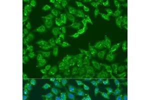 Immunofluorescence analysis of U2OS cells using ADAP1 Polyclonal Antibody at dilution of 1:100. (ADAP1 antibody)