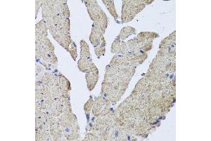 Immunohistochemistry of paraffin-embedded mouse heart using HBA2 antibody. (HBa2 antibody  (AA 1-142))