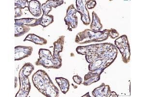 IHC analysis of ANXA4 using anti-ANXA4 antibody (ABIN5518805). (Annexin IV antibody  (Middle Region))