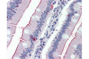 Anti-SLC5A1 / SGLT1 antibody IHC of human small intestine. (SLC5A1 antibody  (Internal Region))