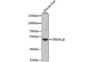 Western blot analysis of extracts of mouse liver, using TRMT61B antibody.