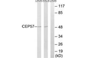 Western blot analysis of extracts from COLO/LOVO cells, using CEP57 Antibody. (CEP57 antibody  (AA 241-290))