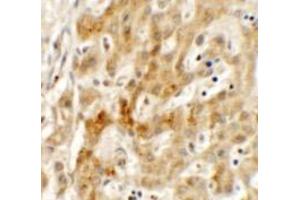 Immunohistochemistry (IHC) image for anti-Transmembrane Protein 106B (TMEM106B) (N-Term) antibody (ABIN1031627) (TMEM106B antibody  (N-Term))
