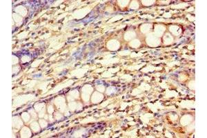 Immunohistochemistry of paraffin-embedded human colon tissue using ABIN7157727 at dilution of 1:100 (KLF4 antibody  (AA 30-230))