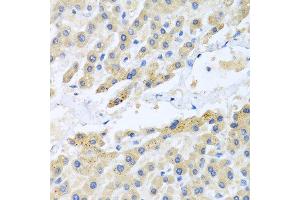 Immunohistochemistry of paraffin-embedded human liver using CCL3 antibody at dilution of 1:100 (40x lens). (CCL3 antibody)