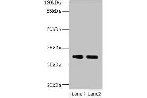 Western blot All lanes: DNALI1 antibody at 1 μg/mL Lane 1: Mouse gonadal tissue Lane 2: Mouse lung tissue Secondary Goat polyclonal to rabbit IgG at 1/10000 dilution Predicted band size: 30, 16 kDa Observed band size: 30 kDa (DNALI1 antibody  (AA 1-258))
