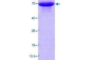 Image no. 1 for Heat Shock 70kDa Protein 6 (HSP70B') (HSPA6) (AA 1-643) protein (His tag) (ABIN5570606) (HSPA6 Protein (AA 1-643) (His tag))
