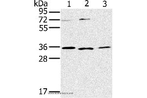 Western blot analysis of SP20, Raji and 231 cell, using IL22RA2 Polyclonal Antibody at dilution of 1:200 (IL22RA2 antibody)
