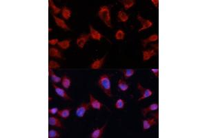 Immunofluorescence analysis of HeLa cells using Caspase-8 antibody (ABIN6131531, ABIN6137971, ABIN6137973 and ABIN6215162) at dilution of 1:100. (Caspase 8 antibody)