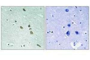 Immunohistochemistry analysis of paraffin-embedded human brain tissue using ILK (Ab-246) antibody. (ILK antibody  (Ser246))
