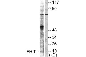 Western blot analysis of extracts from A549 cells, using FHIT antibody (#C0193). (FHIT antibody)